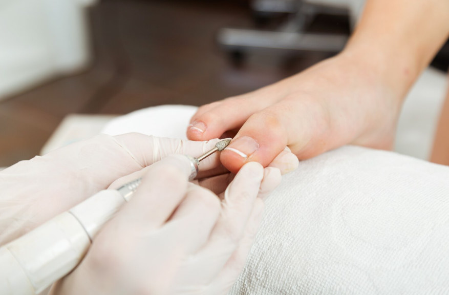 Медичний апаратний педикюр: чому це більше, ніж просто краса, та чим він відрізняється від класичного догляду 